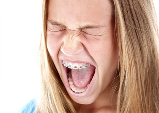 Do Braces Hurt - Pic